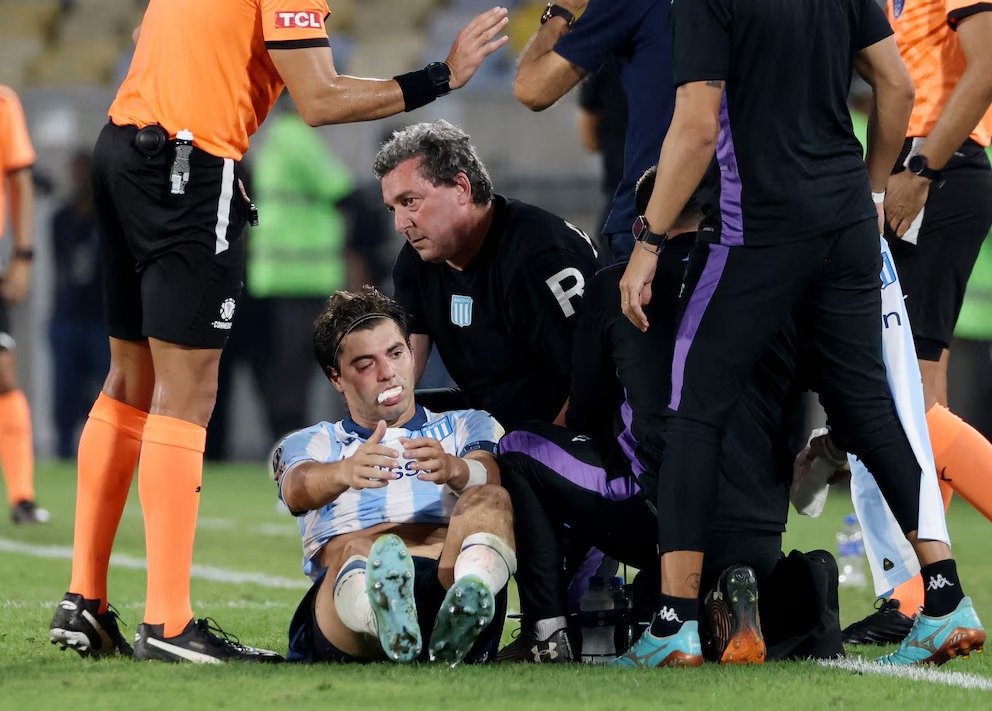 Sosa recibe el alta tras fracturarse la cara en la semifinal con Flamengo